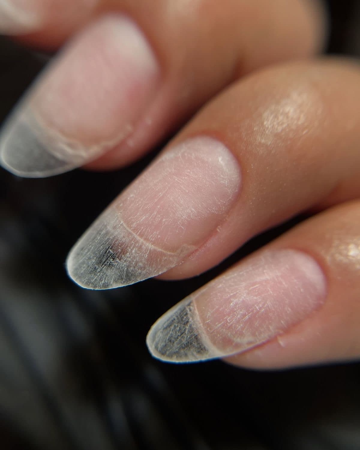Rallongement gel