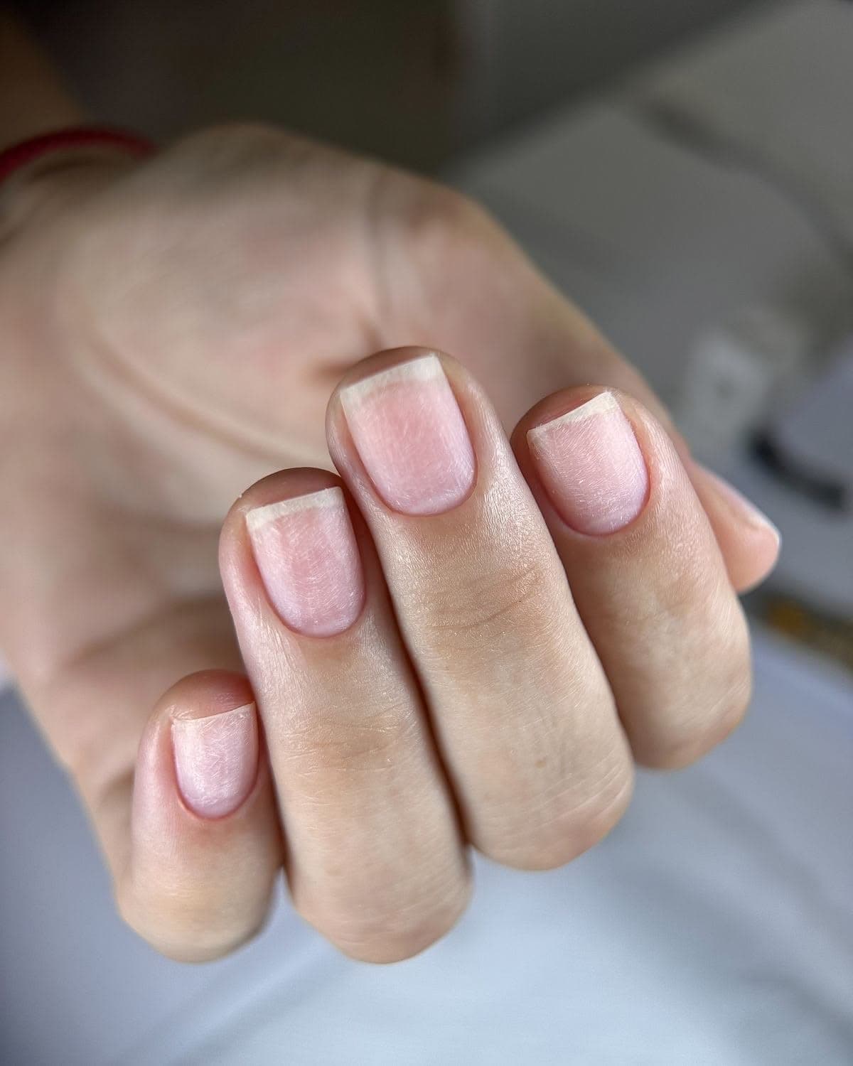 Dépose + soins